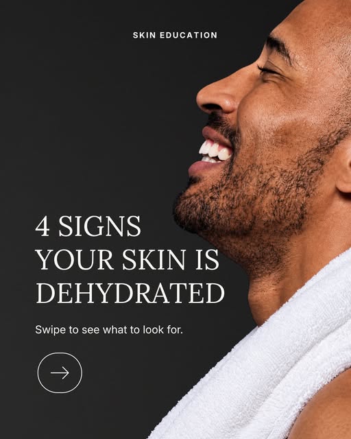 Simply Skin on Instagram