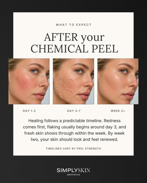 Simply Skin on Instagram